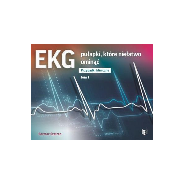 EKG Pułapki które niełatwo ominąć Przypadki kliniczne t.1
