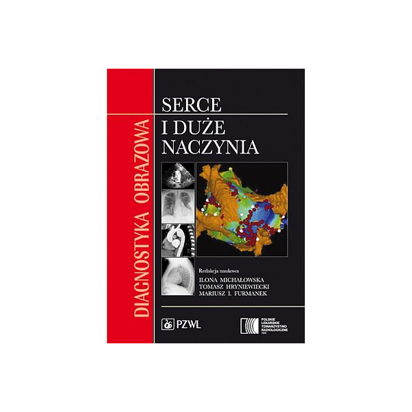 Diagnostyka obrazowa. Serce i duże naczynia