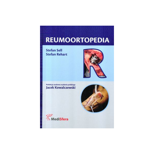 Reumoortopedia