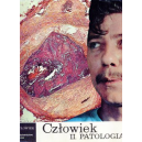 Człowiek II Patologia - Życie i człowiek