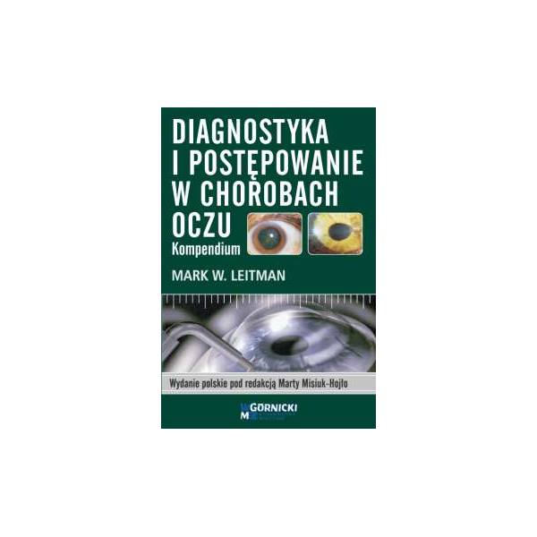 Diagnostyka i postępowanie w chorobach oczu Kompendium