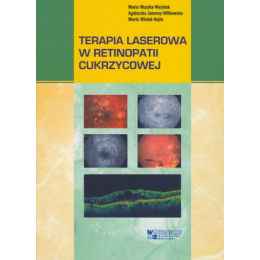 Terapia laserowa w retinopatii cukrzycowej