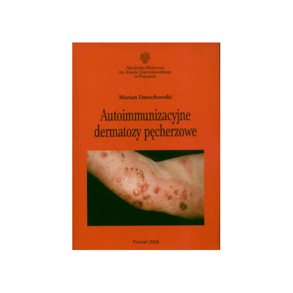 Autoimmunizacyjne dermatozy pęcherzowe