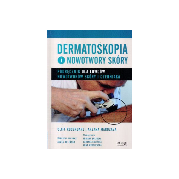 Dermatoskopia i nowotwory skóry Podręcznik dla łowców nowotworów skóry i czerniaka