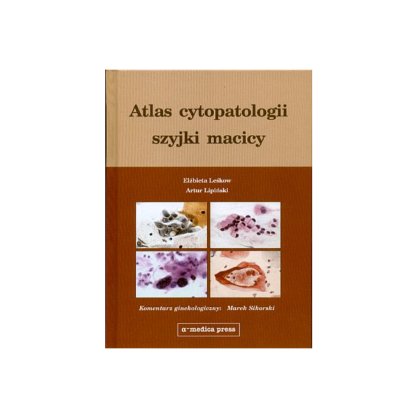 Atlas cytopatologii szyjki macicy