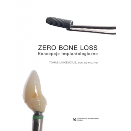 Zero bone loss koncepcje implantologiczne