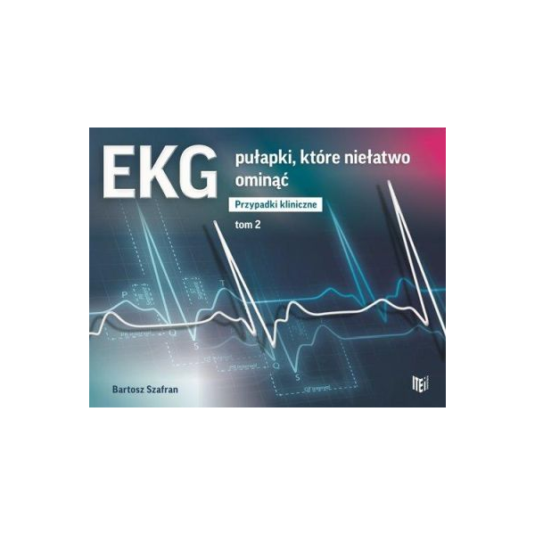 EKG Pułapki które niełatwo ominąć Przypadki kliniczne t.2