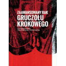 Zaawansowany rak gruczołu krokowego