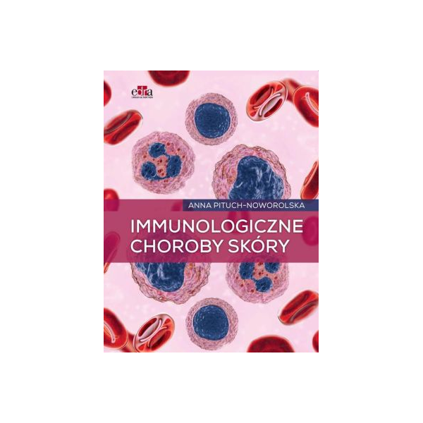 Immunologiczne choroby skóry