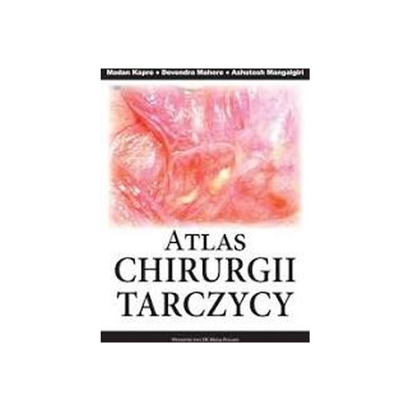 Atlas chirurgii tarczycy