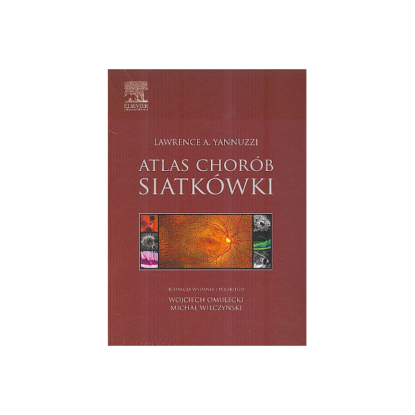 Atlas chorób siatkówki