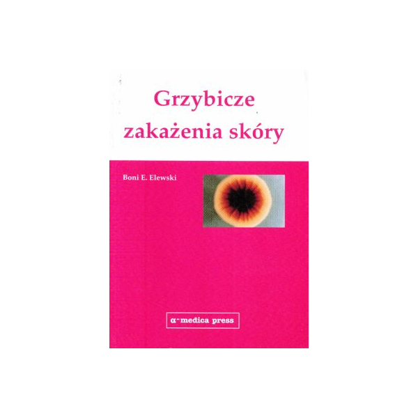 Grzybicze zakażenia skóry