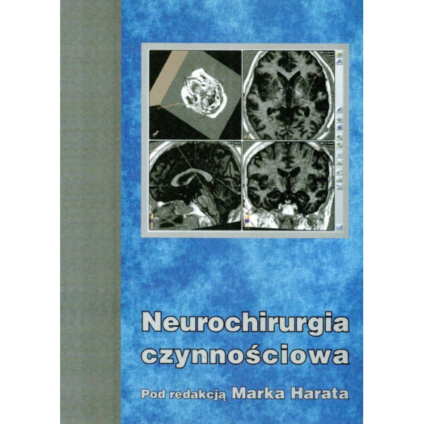 Neurochirurgia czynnościowa