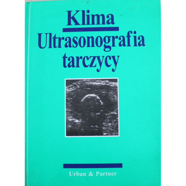 Ultrasonografia tarczycy