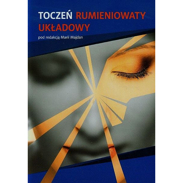 Toczeń rumieniowaty układowy