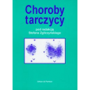 Choroby tarczycy