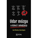 Udar mózgu u dzieci i młodzieży