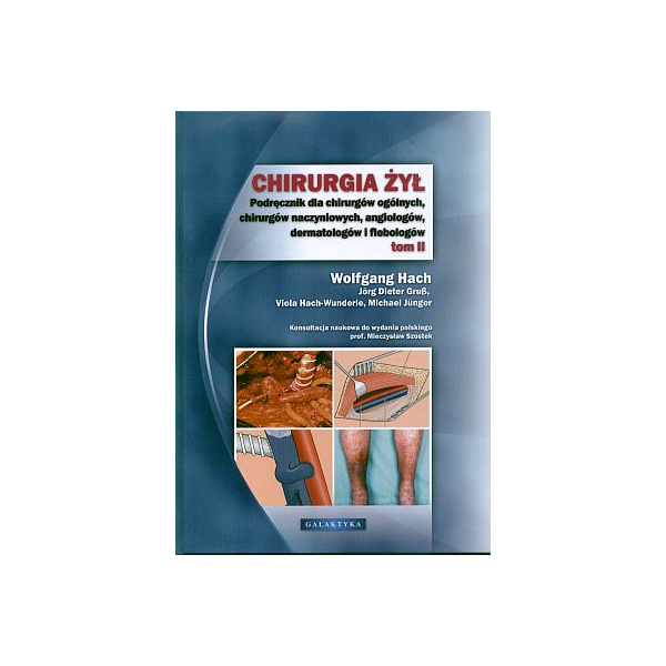 Chirurgia żył t. 2 Podręcznik dla chirurgów ogólnych, chirurgów naczyniowych, angiologów, dermatologów i flebologów