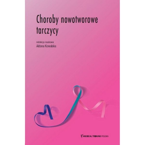 Choroby nowotworowe tarczycy