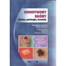 Nowotwory skóry. Klinika, patologia, leczenie