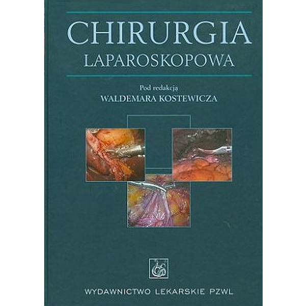 Chirurgia laparoskopowa