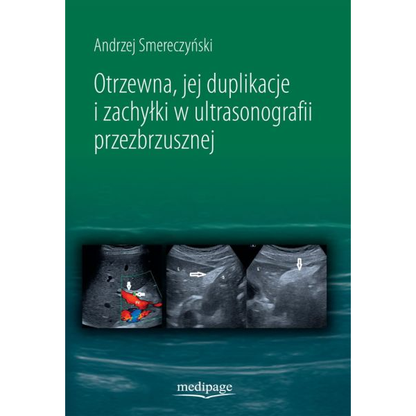 Otrzewna, jej duplikacje i...