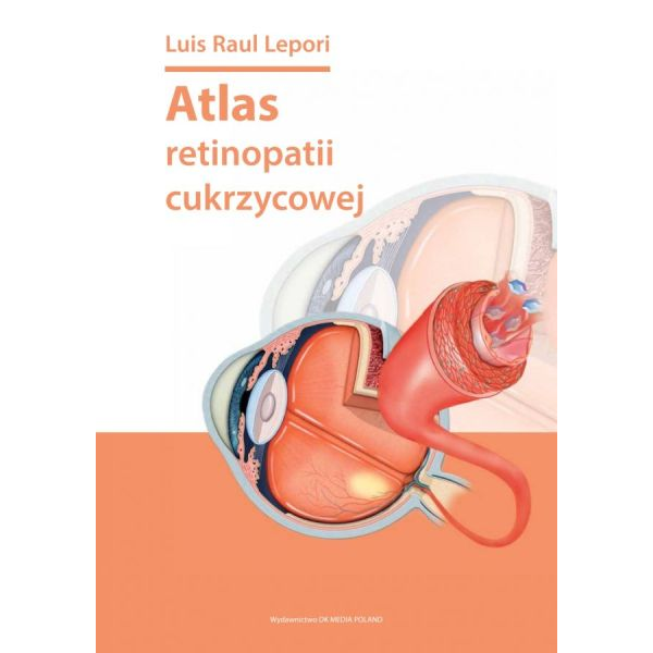 Atlas retinopatii cukrzycowej