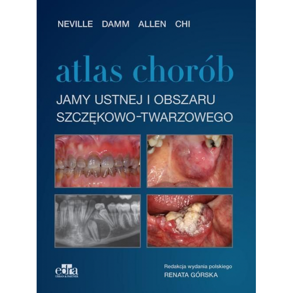 Atlas chorób jamy ustnej i...