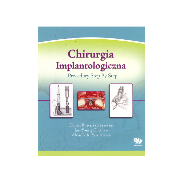 Chirurgia implantologiczna Procedury Step By Step