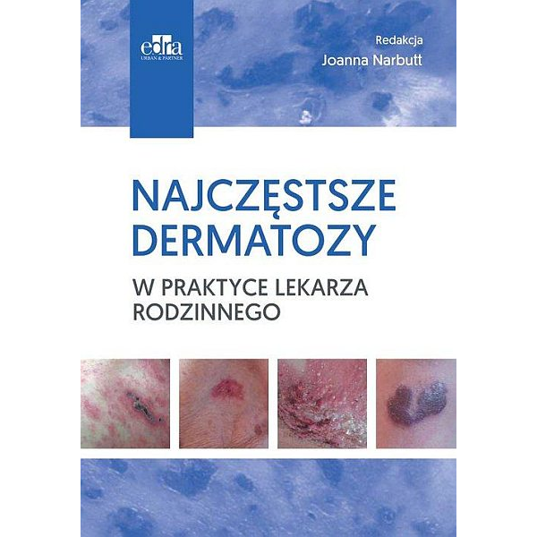 Najczęstrze dermatozy w praktyce lekarza rodzinnego Najczęstrze dermatozy w praktyce lekarza rodzinnego