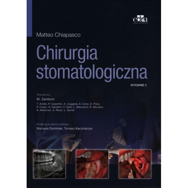 Chirurgia stomatologiczna...