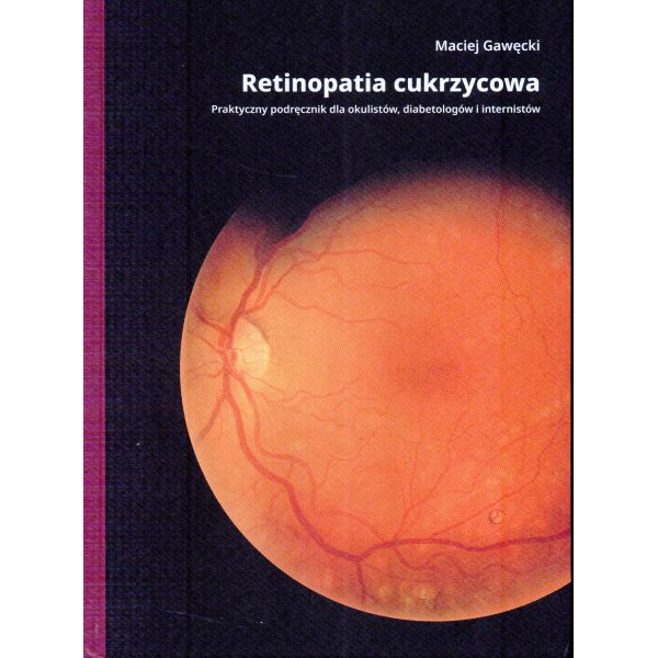 Retinopatia cukrzycowa...