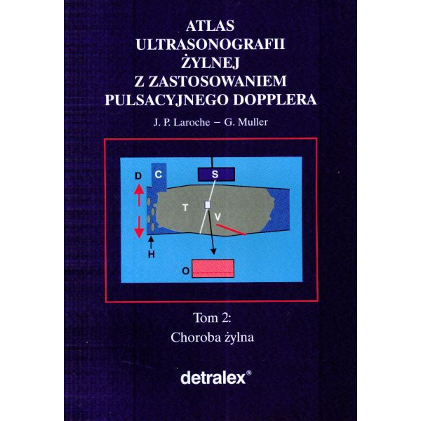 Atlas ultrasonografi żylnej...