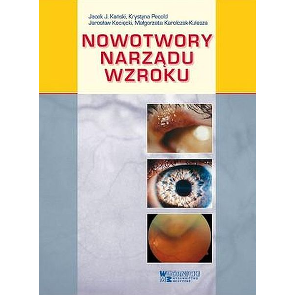 Nowotwory narządu wzroku