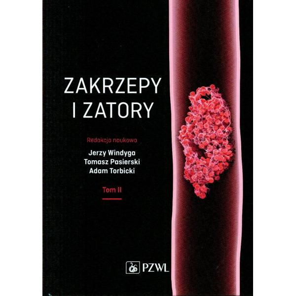 Zakrzepy i zatory t.2