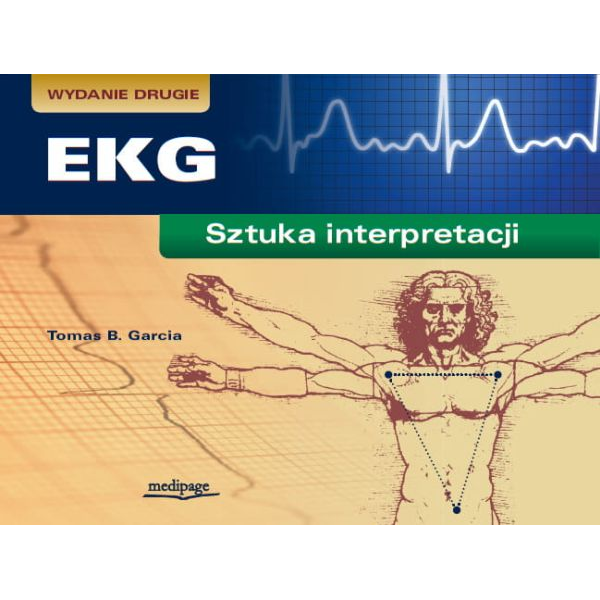 EKG - sztuka interpretacji