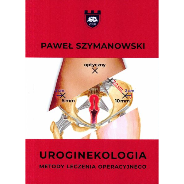 Uroginekologia Metody...