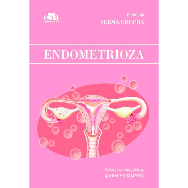 Endometrioza