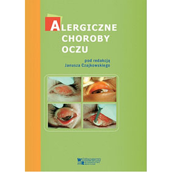 Alergiczne choroby oczu