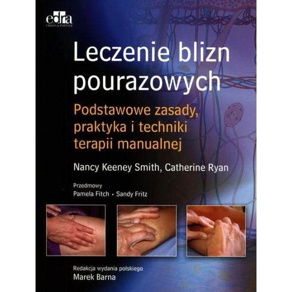 Leczenie blizn pourazowych