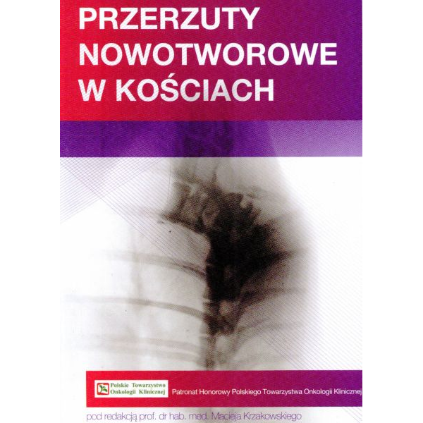 Przerzuty nowotworowe w...