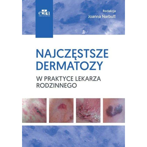 Najczęstsze dermatozy w...