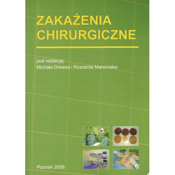 Zakażenia chirurgiczne