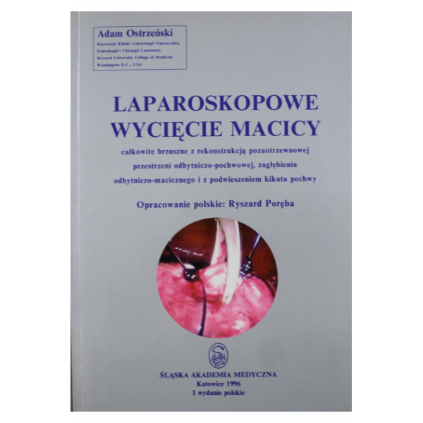 Laparoskopowe wycięcie macicy