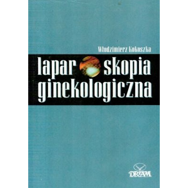 Laparoskopia ginekologiczna