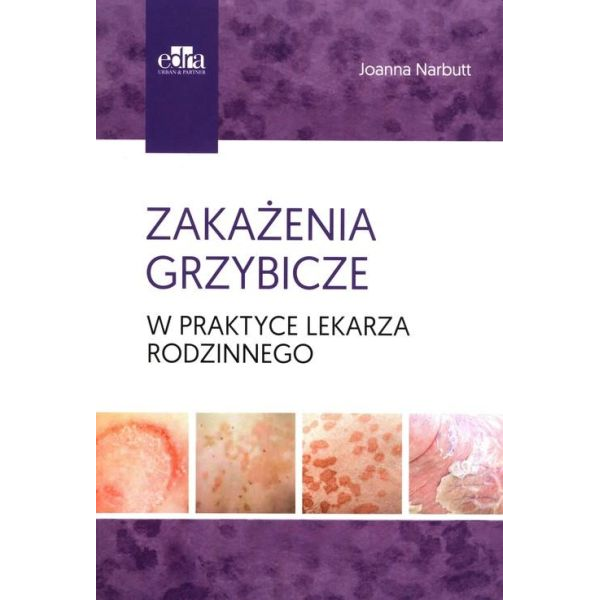 Zakażenia grzybicze w...