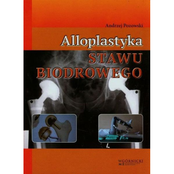 Alloplastyka stawu biodrowego