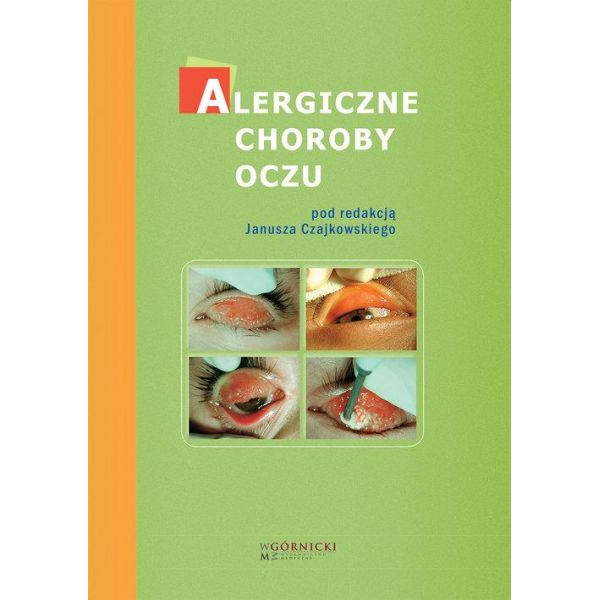 Alergiczne choroby oczu