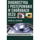 Diagnostyka i postępowanie w chorobach oczu Kompendium
