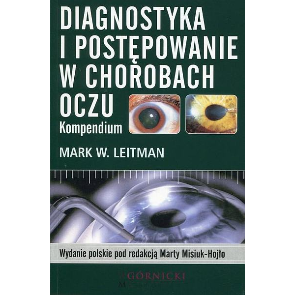 Diagnostyka i postępowanie w chorobach oczu Kompendium